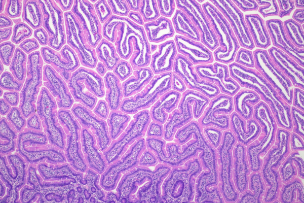 A pink and purple stained image of cells